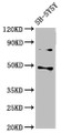Western Blot, Positive WB detected in: SH-SY5Y whole cell lysate, All lanes: CSNK1E antibody at 3ug/ml, Secondary, Goat polyclonal to rabbit IgG at 1/50000 dilution, Predicted band size: 48 kDa, Observed band size: 48 kDa Western Blot, Positive WB detected in: SH-SY5Y whole cell lysate, All lanes: CSNK1E antibody at 3ug/ml, Secondary, Goat polyclonal to rabbit IgG at 1/50000 dilution, Predicted band size: 48 kDa, Observed band size: 48 kDa
