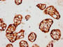 IHC image of CAC13807 diluted at 1:150 and staining in paraffin-embedded human placenta tissue performed on a Leica BondTM system. After dewaxing and hydration, antigen retrieval was mediated by high pressure in a citrate buffer (pH 6.0). Section was blocked with 10% normal goat serum 30min at RT. Then primary antibody (1% BSA) was incubated at 4°C overnight. The primary is detected by a biotinylated secondary antibody and visualized using an HRP conjugated SP system. IHC image of CAC13807 diluted at 1:150 and staining in paraffin-embedded human placenta tissue performed on a Leica BondTM system. After dewaxing and hydration, antigen retrieval was mediated by high pressure in a citrate buffer (pH 6.0). Section was blocked with 10% normal goat serum 30min at RT. Then primary antibody (1% BSA) was incubated at 4°C overnight. The primary is detected by a biotinylated secondary antibody and visualized using an HRP conjugated SP system.