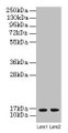Western Blot, All lanes: LSM4 antibody at 2ug/ml, Lane 1: A549 whole cell lysate, Lane 2: K562 whole cell lysate, Secondary, Goat polyclonal to rabbit IgG at 1/10000 dilution, Predicted band size: 16 kDa, Observed band size: 16 kDa