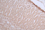 Immunohistochemistry of paraffin-embedded human adrenal gland tissue using CAC13809 at dilution of 1:100
