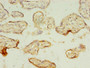 Immunohistochemistry of paraffin-embedded human placenta tissue using CAC13810 at dilution of 1:100 Immunohistochemistry of paraffin-embedded human placenta tissue using CAC13810 at dilution of 1:100