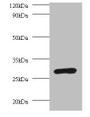 Western Blot, All lanes: PSMA7 antibody at 2ug/ml + 293T whole cell lysate, Secondary, Goat polyclonal to rabbit IgG at 1/10000 dilution, Predicted band size: 28, 21, 17 kDa, Observed band size: 28 kDa Western Blot, All lanes: PSMA7 antibody at 2ug/ml + 293T whole cell lysate, Secondary, Goat polyclonal to rabbit IgG at 1/10000 dilution, Predicted band size: 28, 21, 17 kDa, Observed band size: 28 kDa