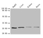 Western Blot, All lanes: PSMA7 antibody at 1.6 ug/ml, Lane 1: HepG2 whole cell lysate, Lane 2: Mouse liver tissue, Lane 3: Mouse kidney tissue, Lane 4: Mouse brain tissue, Secondary, Goat polyclonal to rabbit IgG at 1/10000 dilution, Predicted band size: 28, 21, 17 kDa, Observed band size: 28 kDa Western Blot, All lanes: PSMA7 antibody at 1.6 ug/ml, Lane 1: HepG2 whole cell lysate, Lane 2: Mouse liver tissue, Lane 3: Mouse kidney tissue, Lane 4: Mouse brain tissue, Secondary, Goat polyclonal to rabbit IgG at 1/10000 dilution, Predicted band size: 28, 21, 17 kDa, Observed band size: 28 kDa