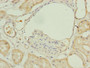Immunohistochemistry of paraffin-embedded human kidney tissue using CAC13812 at dilution of 1:100 Immunohistochemistry of paraffin-embedded human kidney tissue using CAC13812 at dilution of 1:100