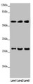 Western Blot, All lanes: MAOB antibody at 9ug/ml, Lane 1: Mouse liver tissue, Lane 2: HepG2 whole cell lysate, Lane 3: A549 whole cell lysate, Secondary, Goat polyclonal to rabbit IgG at 1/10000 dilution, Predicted band size: 59, 47 kDa, Observed band size: 59, 27 kDa Western Blot, All lanes: MAOB antibody at 9ug/ml, Lane 1: Mouse liver tissue, Lane 2: HepG2 whole cell lysate, Lane 3: A549 whole cell lysate, Secondary, Goat polyclonal to rabbit IgG at 1/10000 dilution, Predicted band size: 59, 47 kDa, Observed band size: 59, 27 kDa