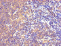 IHC image of CAC13813 diluted at 1:300 and staining in paraffin-embedded human lymph node tissue performed on a Leica BondTM system. After dewaxing and hydration, antigen retrieval was mediated by high pressure in a citrate buffer (pH 6.0). Section was blocked with 10% normal goat serum 30min at RT. Then primary antibody (1% BSA) was incubated at 4°C overnight. The primary is detected by a biotinylated secondary antibody and visualized using an HRP conjugated SP system. IHC image of CAC13813 diluted at 1:300 and staining in paraffin-embedded human lymph node tissue performed on a Leica BondTM system. After dewaxing and hydration, antigen retrieval was mediated by high pressure in a citrate buffer (pH 6.0). Section was blocked with 10% normal goat serum 30min at RT. Then primary antibody (1% BSA) was incubated at 4°C overnight. The primary is detected by a biotinylated secondary antibody and visualized using an HRP conjugated SP system.