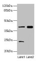 Western Blot, All lanes: MAP2K3 antibody at 10ug/ml, Lane 1: RAW264.7 whole cell lysate, Lane 2: Mouse skeletal muscle tissue, Secondary, Goat polyclonal to rabbit IgG at 1/10000 dilution, Predicted band size: 40, 37 kDa, Observed band size: 40 kDa Western Blot, All lanes: MAP2K3 antibody at 10ug/ml, Lane 1: RAW264.7 whole cell lysate, Lane 2: Mouse skeletal muscle tissue, Secondary, Goat polyclonal to rabbit IgG at 1/10000 dilution, Predicted band size: 40, 37 kDa, Observed band size: 40 kDa