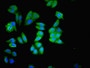 Immunofluorescence staining of HepG2 cells with CAC13817 at 1:200, counter-stained with DAPI. The cells were fixed in 4% formaldehyde, permeabilized using 0.2% Triton X-100 and blocked in 10% normal Goat Serum. The cells were then incubated with the antibody overnight at 4°C. The secondary antibody was Alexa Fluor 488-congugated AffiniPure Goat Anti-Rabbit IgG(H+L). Immunofluorescence staining of HepG2 cells with CAC13817 at 1:200, counter-stained with DAPI. The cells were fixed in 4% formaldehyde, permeabilized using 0.2% Triton X-100 and blocked in 10% normal Goat Serum. The cells were then incubated with the antibody overnight at 4°C. The secondary antibody was Alexa Fluor 488-congugated AffiniPure Goat Anti-Rabbit IgG(H+L).