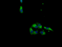 Immunofluorescent analysis of HepG2 cells using CAC13819 at dilution of 1:100 and Alexa Fluor 488-congugated AffiniPure Goat Anti-Rabbit IgG(H+L) Immunofluorescent analysis of HepG2 cells using CAC13819 at dilution of 1:100 and Alexa Fluor 488-congugated AffiniPure Goat Anti-Rabbit IgG(H+L)