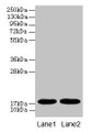 Western Blot, All lanes: MB antibody at 2ug/ml, Lane 1: Rat heart tissue, Lane 2: Mouse heart tissue, Secondary, Goat polyclonal to rabbit IgG at 1/10000 dilution, Predicted band size: 18 kDa, Observed band size: 18 kDa Western Blot, All lanes: MB antibody at 2ug/ml, Lane 1: Rat heart tissue, Lane 2: Mouse heart tissue, Secondary, Goat polyclonal to rabbit IgG at 1/10000 dilution, Predicted band size: 18 kDa, Observed band size: 18 kDa