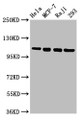 Western Blot, Positive WB detected in: Hela whole cell lysate, MCF-7 whole cell lysate, Raji whole cell lysate, 293 whole cell lysate, All lanes: MCM2 antibody at 4.8ug/ml, Secondary, Goat polyclonal to rabbit IgG at 1/50000 dilution, Predicted band size: 102 kDa, Observed band size: 102 kDa Western Blot, Positive WB detected in: Hela whole cell lysate, MCF-7 whole cell lysate, Raji whole cell lysate, 293 whole cell lysate, All lanes: MCM2 antibody at 4.8ug/ml, Secondary, Goat polyclonal to rabbit IgG at 1/50000 dilution, Predicted band size: 102 kDa, Observed band size: 102 kDa