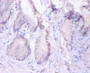 Immunohistochemistry of paraffin-embedded human prostate tissue using CAC13823 at dilution of 1:100 Immunohistochemistry of paraffin-embedded human prostate tissue using CAC13823 at dilution of 1:100