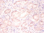 Immunohistochemistry of paraffin-embedded human kidney tissue using CAC13826 at dilution of 1:100 Immunohistochemistry of paraffin-embedded human kidney tissue using CAC13826 at dilution of 1:100