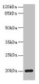 Western Blot, All lanes: MPV17 antibody at 2ug/ml + Mouse heart tissue, Secondary, Goat polyclonal to rabbit IgG at 1/10000 dilution, Predicted band size: 20 kDa, Observed band size: 20 kDa
