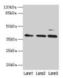 Western Blot, All lanes: MRPL3 antibody at 6ug/ml, Lane 1: Hela whole cell lysate, Lane 2: HepG2 whole cell lysate, Lane 3: A549 whole cell lysate, Secondary, Goat polyclonal to rabbit IgG at 1/10000 dilution, Predicted band size: 39 kDa, Observed band size: 39 kDa Western Blot, All lanes: MRPL3 antibody at 6ug/ml, Lane 1: Hela whole cell lysate, Lane 2: HepG2 whole cell lysate, Lane 3: A549 whole cell lysate, Secondary, Goat polyclonal to rabbit IgG at 1/10000 dilution, Predicted band size: 39 kDa, Observed band size: 39 kDa