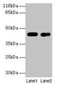 Western Blot, All lanes: CKB antibody at 2ug/ml, Lane 1: Mouse brain tissue, Lane 2: 293T whole cell lysate, Secondary, Goat polyclonal to rabbit IgG at 1/10000 dilution, Predicted band size: 43 kDa, Observed band size: 43 kDa Western Blot, All lanes: CKB antibody at 2ug/ml, Lane 1: Mouse brain tissue, Lane 2: 293T whole cell lysate, Secondary, Goat polyclonal to rabbit IgG at 1/10000 dilution, Predicted band size: 43 kDa, Observed band size: 43 kDa