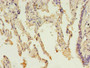 Immunohistochemistry of paraffin-embedded human lung tissue using CAC13836 at dilution of 1:100 Immunohistochemistry of paraffin-embedded human lung tissue using CAC13836 at dilution of 1:100