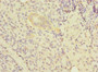 Immunohistochemistry of paraffin-embedded human pancreatic tissue using CAC13844 at dilution of 1:100 Immunohistochemistry of paraffin-embedded human pancreatic tissue using CAC13844 at dilution of 1:100