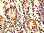 Immunohistochemistry of paraffin-embedded human appendix tissue using CAC13852 at dilution of 1:100 Immunohistochemistry of paraffin-embedded human appendix tissue using CAC13852 at dilution of 1:100