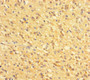 Immunohistochemistry of paraffin-embedded human glioma using CAC13868 at dilution of 1:100