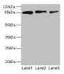 Western Blot, All lanes: PLOD2 antibody at 12ug/ml, Lane 1: U87 whole cell lysate, Lane 2: U251 whole cell lysate, Lane 3: 293T whole cell lysate, Secondary, Goat polyclonal to rabbit IgG at 1/10000 dilution, Predicted band size: 85, 88, 50 kDa, Observed band size: 85 kDa