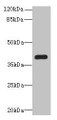 Western Blot, All lanes: PNMA1 antibody at 4ug/ml + Mouse brain tissue, Secondary, Goat polyclonal to rabbit IgG at 1/10000 dilution, Predicted band size: 40 kDa, Observed band size: 40 kDa Western Blot, All lanes: PNMA1 antibody at 4ug/ml + Mouse brain tissue, Secondary, Goat polyclonal to rabbit IgG at 1/10000 dilution, Predicted band size: 40 kDa, Observed band size: 40 kDa