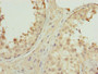 Immunohistochemistry of paraffin-embedded human testis tissue using CAC13871 at dilution of 1:100 Immunohistochemistry of paraffin-embedded human testis tissue using CAC13871 at dilution of 1:100