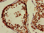 Immunohistochemistry of paraffin-embedded human testis tissue using CAC13879 at dilution of 1:100