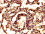 IHC image of CAC13883 diluted at 1:500 and staining in paraffin-embedded human lung tissue performed on a Leica BondTM system. After dewaxing and hydration, antigen retrieval was mediated by high pressure in a citrate buffer (pH 6.0). Section was blocked with 10% normal goat serum 30min at RT. Then primary antibody (1% BSA) was incubated at 4°C overnight. The primary is detected by a biotinylated secondary antibody and visualized using an HRP conjugated SP system. IHC image of CAC13883 diluted at 1:500 and staining in paraffin-embedded human lung tissue performed on a Leica BondTM system. After dewaxing and hydration, antigen retrieval was mediated by high pressure in a citrate buffer (pH 6.0). Section was blocked with 10% normal goat serum 30min at RT. Then primary antibody (1% BSA) was incubated at 4°C overnight. The primary is detected by a biotinylated secondary antibody and visualized using an HRP conjugated SP system.