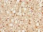 IHC image of CAC13883 diluted at 1:500 and staining in paraffin-embedded human brain tissue performed on a Leica BondTM system. After dewaxing and hydration, antigen retrieval was mediated by high pressure in a citrate buffer (pH 6.0). Section was blocked with 10% normal goat serum 30min at RT. Then primary antibody (1% BSA) was incubated at 4°C overnight. The primary is detected by a biotinylated secondary antibody and visualized using an HRP conjugated SP system. IHC image of CAC13883 diluted at 1:500 and staining in paraffin-embedded human brain tissue performed on a Leica BondTM system. After dewaxing and hydration, antigen retrieval was mediated by high pressure in a citrate buffer (pH 6.0). Section was blocked with 10% normal goat serum 30min at RT. Then primary antibody (1% BSA) was incubated at 4°C overnight. The primary is detected by a biotinylated secondary antibody and visualized using an HRP conjugated SP system.