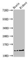 Western Blot, Positive WB detected in: Mouse brain tissue, Mouse kidney tissue, All lanes: PVALB antibody at 3ug/ml, Secondary, Goat polyclonal to rabbit IgG at 1/50000 dilution, Predicted band size: 13 kDa, Observed band size: 13 kDa