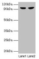 Western Blot, All lanes: PYGL antibody at 2ug/ml, Lane 1: 293T whole cell lysate, Lane 2: HepG2 whole cell lysate, Secondary, Goat polyclonal to rabbit IgG at 1/10000 dilution, Predicted band size: 98, 94 kDa, Observed band size: 98 kDa