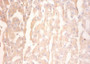 Immunohistochemistry of paraffin-embedded human liver tissue using CAC13890 at dilution of 1:100