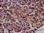 IHC image of CAC13895 diluted at 1:1200 and staining in paraffin-embedded human pancreatic tissue performed on a Leica BondTM system. After dewaxing and hydration, antigen retrieval was mediated by high pressure in a citrate buffer (pH 6.0). Section was blocked with 10% normal goat serum 30min at RT. Then primary antibody (1% BSA) was incubated at 4°C overnight. The primary is detected by a biotinylated secondary antibody and visualized using an HRP conjugated SP system.