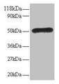 Western Blot, All lanes: LMO1 antibody at 2ug/ml, Lane 1: EC109 whole cell lysate, Lane 2: 293T whole cell lysate, Secondary, Goat polyclonal to rabbit IgG at 1/15000 dilution, Predicted band size: 18 kDa, Observed band size: 50 kDa