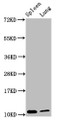 Western Blot, Positive WB detected in: Mouse spleen tissue, Mouse lung tissue, All lanes: S100a8 antibody at 3.8ug/ml, Secondary, Goat polyclonal to rabbit IgG at 1/50000 dilution, Predicted band size: 11 kDa, Observed band size: 11 kDa