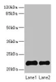 Western Blot, All lanes: SIRPD antibody at 14ug/ml, Lane 1: 293T whole cell lysate, Lane 2: Mouse spleen tissue, Secondary, Goat polyclonal to rabbit IgG at 1/10000 dilution, Predicted band size: 22 kDa, Observed band size: 22 kDa