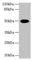 Western Blot, All lanes: TUFM antibody at 2ug/ml + U251 whole cell lysate, Secondary, Goat polyclonal to rabbit IgG at 1/10000 dilution, Predicted band size: 50 kDa, Observed band size: 50 kDa Western Blot, All lanes: TUFM antibody at 2ug/ml + U251 whole cell lysate, Secondary, Goat polyclonal to rabbit IgG at 1/10000 dilution, Predicted band size: 50 kDa, Observed band size: 50 kDa
