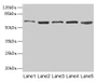 Western Blot, All lanes: STIP1 antibody at 12ug/ml, Lane 1: Hela whole cell lysate, Lane 2: HepG2 whole cell lysate, Lane 3: NIH/3T3 whole cell lysate, Lane 4: Jurkat whole cell lysate, Lane 5: Rat gonadal tissue, Secondary, Goat polyclonal to rabbit IgG at 1/10000 dilution, Predicted band size: 63, 69, 60 kDa, Observed band size: 63 kDa