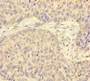 Immunohistochemistry of paraffin-embedded human ovarian cancer using CAC13946 at dilution of 1:100