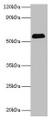 Western Blot, All lanes: SUOX antibody at 2ug/ml + Rat liver tissue, Secondary, Goat polyclonal to rabbit IgG at 1/15000 dilution, Predicted band size: 61 kDa, Observed band size: 61 kDa