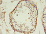 Immunohistochemistry of paraffin-embedded human testis tissue using CAC13955 at dilution of 1:100