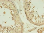 Immunohistochemistry of paraffin-embedded human testis tissue using CAC13962 at dilution of 1:100