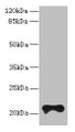Western Blot, All lanes: TMEM154 antibody at 6ug/ml + MCF-7 whole cell lysate, Secondary, Goat polyclonal to rabbit IgG at 1/10000 dilution, Predicted band size: 21 kDa, Observed band size: 21 kDa