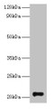 Western Blot, All lanes: GM2A antibody at 2ug/ml + Rat kidney tissue, Secondary, Goat polyclonal to rabbit IgG at 1/10000 dilution, Predicted band size: 21 kDa, Observed band size: 21 kDa