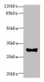 Western Blot, All lanes: TMEM41A antibody at 0.5ug/ml + Mouse liver tissue, Secondary, Goat polyclonal to rabbit IgG at 1/10000 dilution, Predicted band size: 30 kDa, Observed band size: 30 kDa