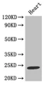 Western Blot, Positive WB detected in: Mouse heart tissue, All lanes: TIMP1 antibody at 2ug/ml, Secondary, Goat polyclonal to rabbit IgG at 1/50000 dilution, Predicted band size: 24 kDa, Observed band size: 24 kDa