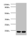 Western Blot, All lanes: RPS13 antibody at 2ug/ml, Lane 1: EC109 whole cell lysate, Lane 2: 293T whole cell lysate, Secondary, Goat polyclonal to rabbit IgG at 1/15000 dilution, Predicted band size: 18 kDa, Observed band size: 18 kDa