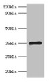 Western Blot, All lanes: RPL5 antibody at 2ug/ml + EC109 whole cell lysate, Secondary, Goat polyclonal to rabbit IgG at 1/15000 dilution, Predicted band size: 35 kDa, Observed band size: 35 kDa