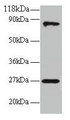 Western Blot, All lanes: RPL17 antibody at 2ug/ml + EC109 whole cell lysate, Secondary, Goat polyclonal to rabbit IgG at 1/15000 dilution, Predicted band size: 22, 18, 27 kDa, Observed band size: 27, 80 kDa